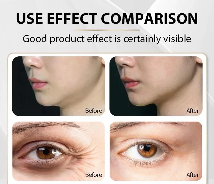 New 7D Hifu Arrival Beauty SPA Equipment Skin Tightening Wrinkle Removal V-Line Facial Lifting Anti Aging Himfu Mfu Machine